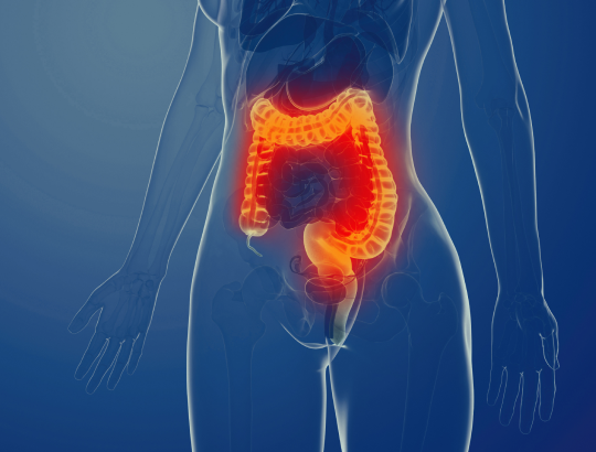 Дивертикулярная болезнь: новая информация для специалистов